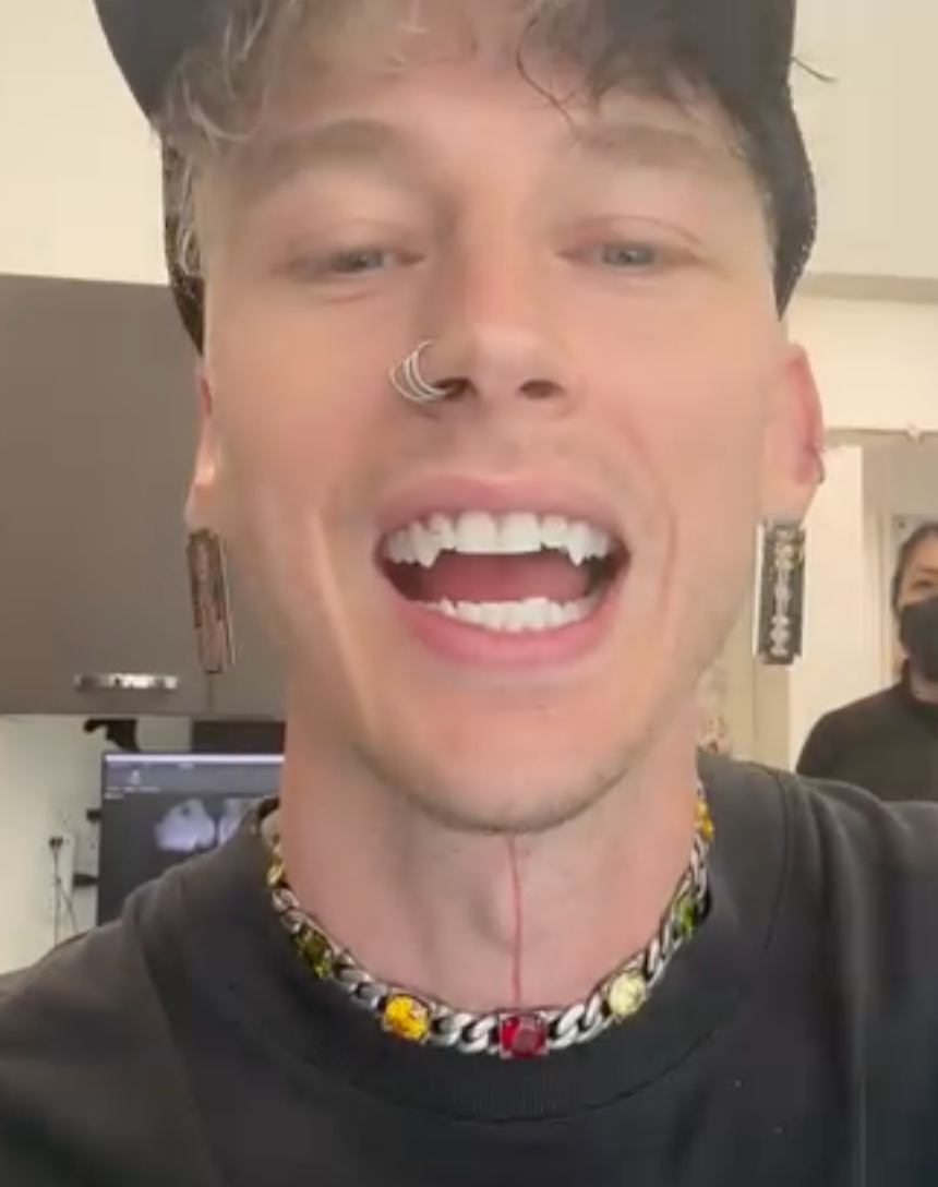 Machine Gun Kelly debuts new fang teeth in dentist’s…